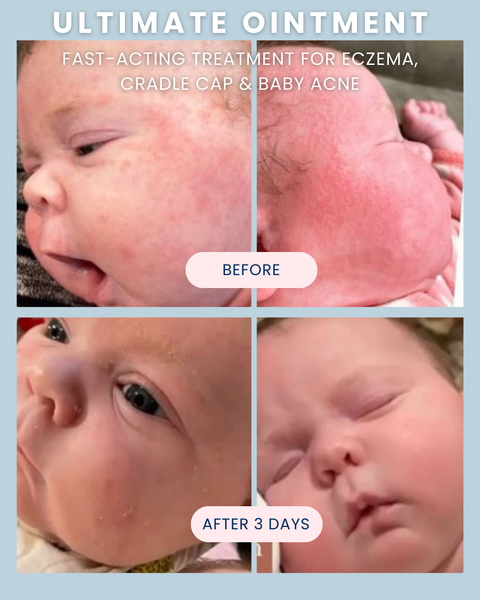 Ultimate Baby Ointment