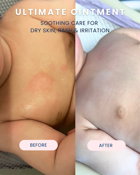 Ultimate Baby Ointment
