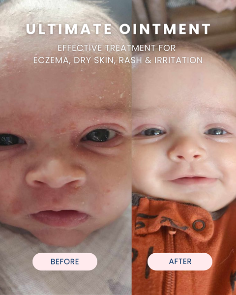Ultimate Baby Ointment